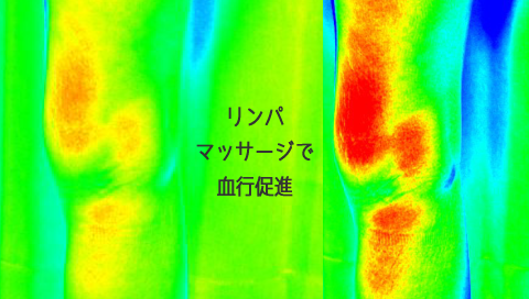 �����p�}�b�T�[�W,�����b�g,���s���i,�T�[���O���t�B�[,�ނ��݉��P,���b�R��